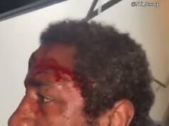 ‘Serial Spitter’ que supostamente tinha como alvo mulheres brancas é espancado por gangue na rua