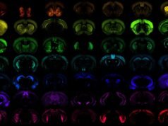 Allen Institute recorre a AWS e Google para estimular ‘momentos aha’ na neurociência com nova plataforma de pesquisa cerebral