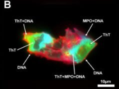 Pessoas com Covid longa têm uma coisa estranha no sangue