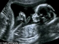 KHADIJA KHAN: Os usuários do cordão temem ser chamados de racistas. É por isso que eles fecham os olhos ao aborto seletivo de sexo