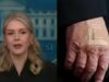 Karoline Leavitt revela porque há bandagens na mão de Trump: ‘O presidente está literalmente…’