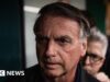 Bolsonaro faz tratamento médico para soluços
