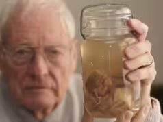 O cérebro de Albert Einstein foi roubado por um médico e carregado por 40 anos