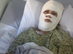 Mulher da Geórgia hospitalizada após agressor lançar produto químico corrosivo durante caminhada noturna