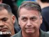Cirurgia de hérnia do ex-presidente Jair Bolsonaro é ‘bem-sucedida’