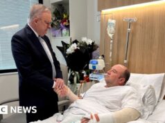 ‘O melhor do nosso país’: primeiro-ministro australiano visita herói de Bondi no hospital