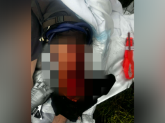 Pescador sobrevive a ataque quase deadly de tubarão com cuidados que salvam vidas, instintos que o mantiveram vivo