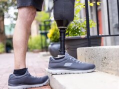 Passos de Fé: Como "Ted Lasso" a estrela Jason Sudeikis e amigos trouxeram esperança aos amputados