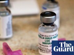 Crianças do Reino Unido receberão vacina contra catapora com sarampo, caxumba e rubéola